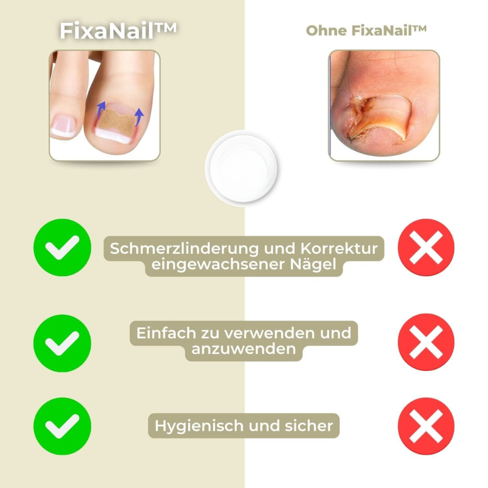 NailStrip™ | Voorkom ingegroeide nagels pijnvrij!