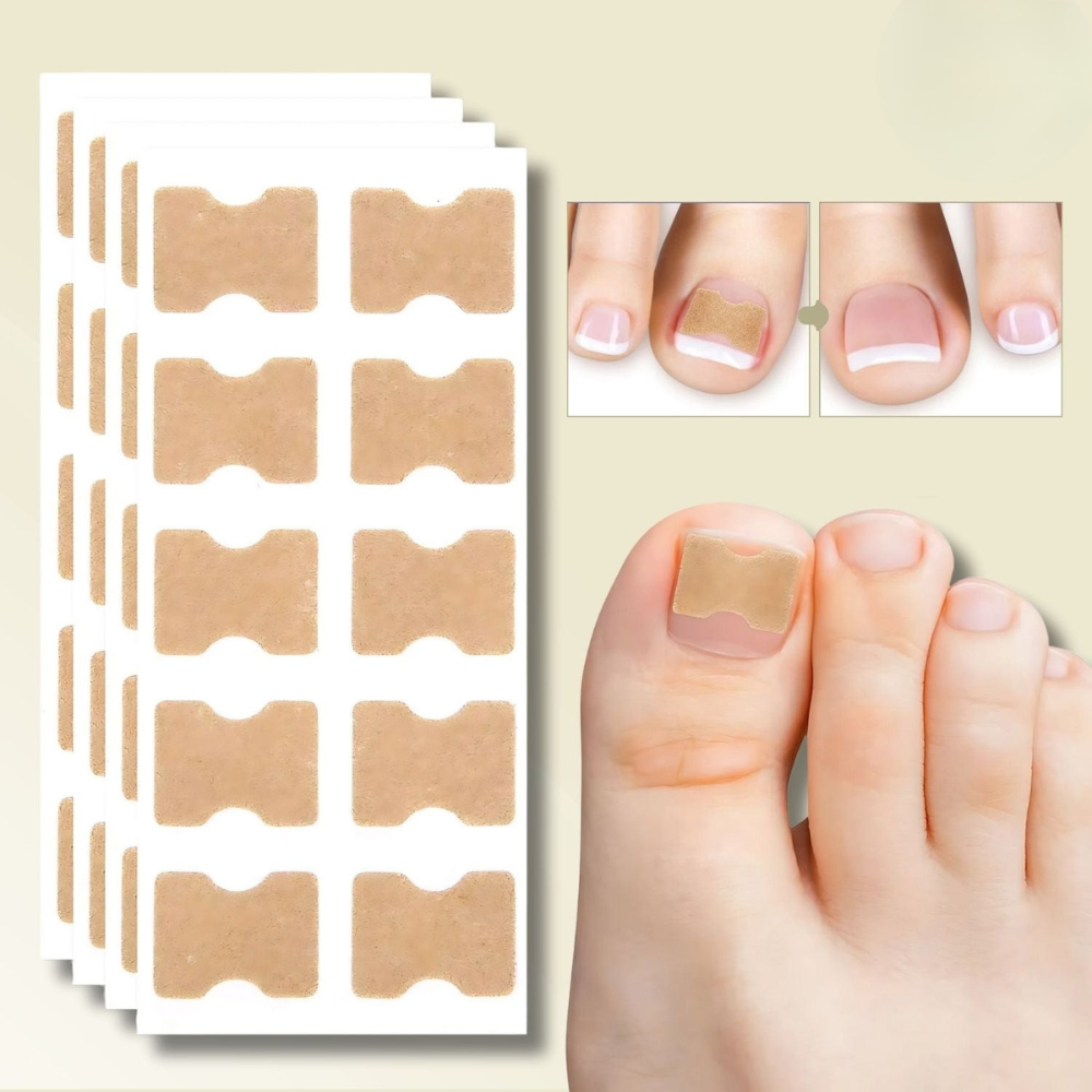 NailStrip™ | Voorkom ingegroeide nagels pijnvrij!