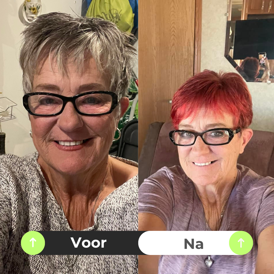 NovaHair™ | Zeg grijs haar gedag binnen 10 min!