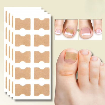 NailStrip™ | Voorkom ingegroeide nagels pijnvrij!