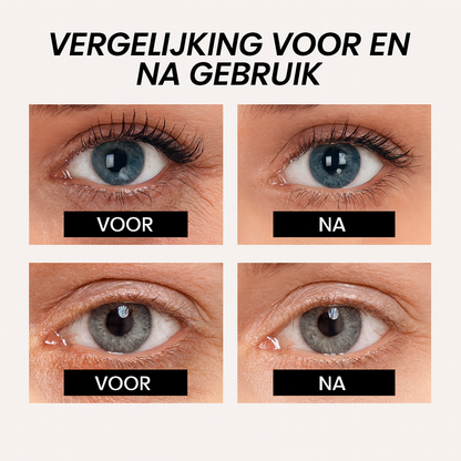SmoothSkin™ | Zomerdeal vandaag 1+1 gratis!