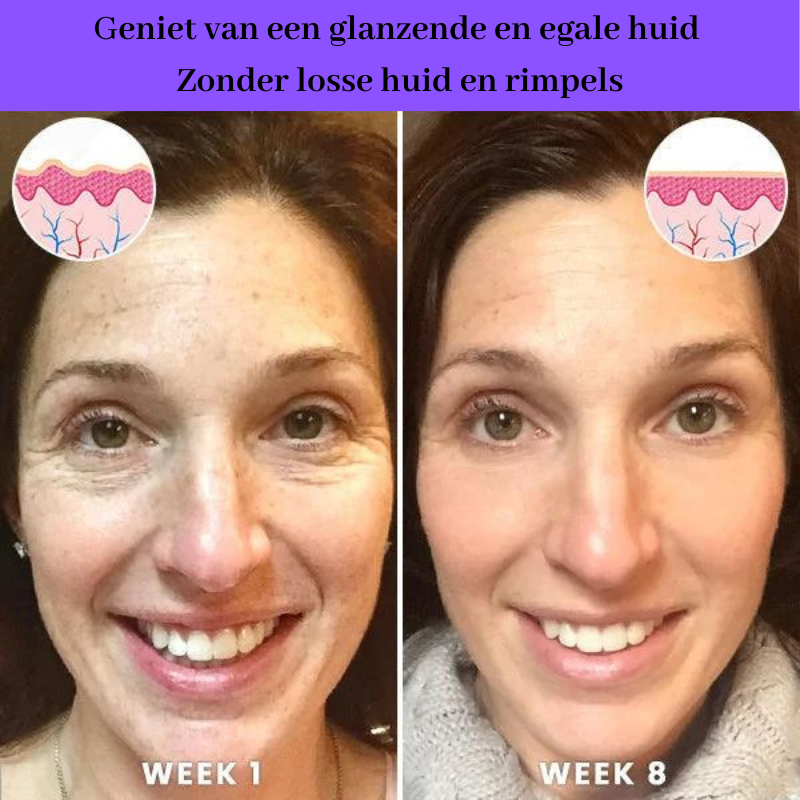 AntiAge™ Huid liftende serum | Vandaag 1+2 Gratis