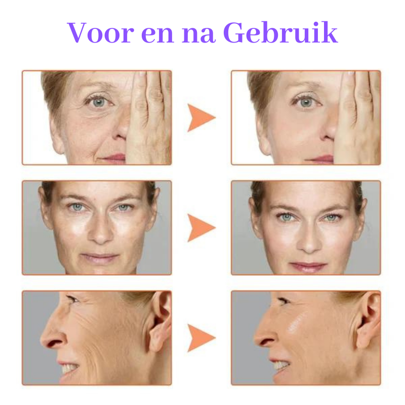 AntiAge™ Huid liftende serum | Vandaag 1+2 Gratis