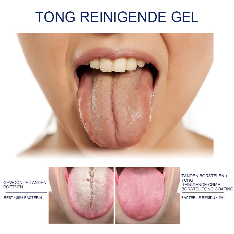 Tong reinigingsgel set