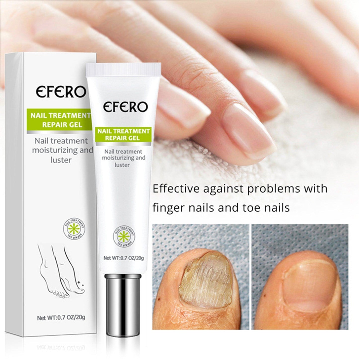 Efero™ - Premium schimmelwerende nagelgel (1+1 GRATIS)